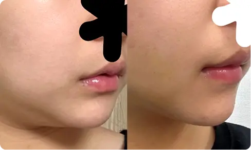 Even asking about small procedures felt easy.